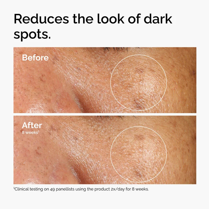 https://allurify.pk/products/the-ordinary-alpha-arbutin-2-ha-30ml?variant=51723054547260