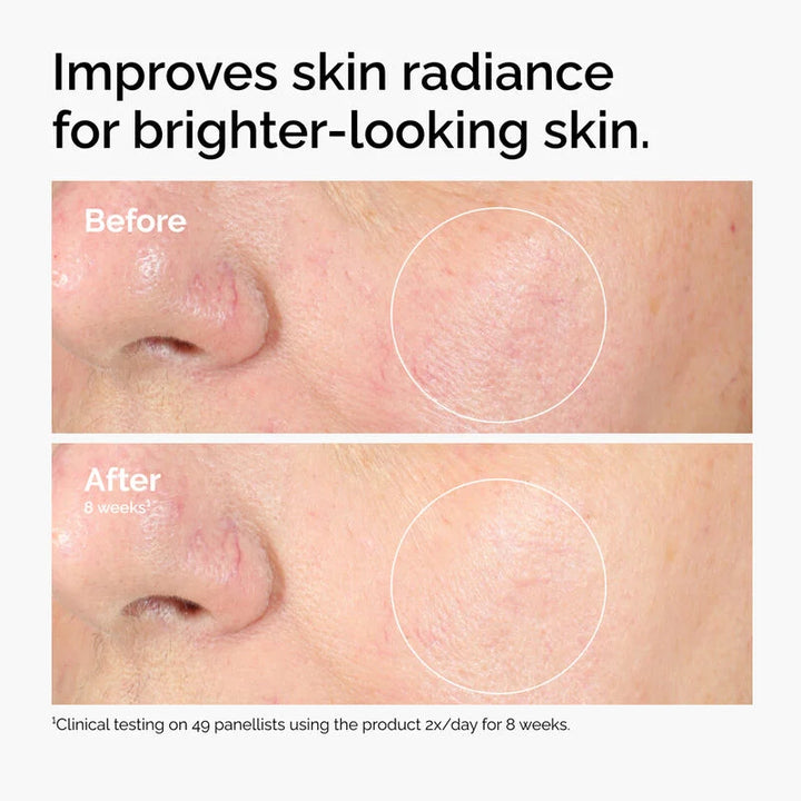 https://allurify.pk/products/the-ordinary-alpha-arbutin-2-ha-30ml?variant=51723054547260