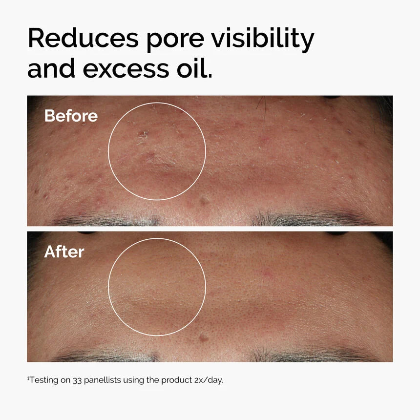 https://allurify.pk/products/the-ordinary-niacinamide-10-zinc-1-30ml?variant=51723044258108