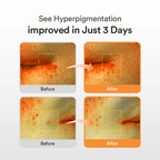 Abib serum for hyperpigmentation and dark spot care