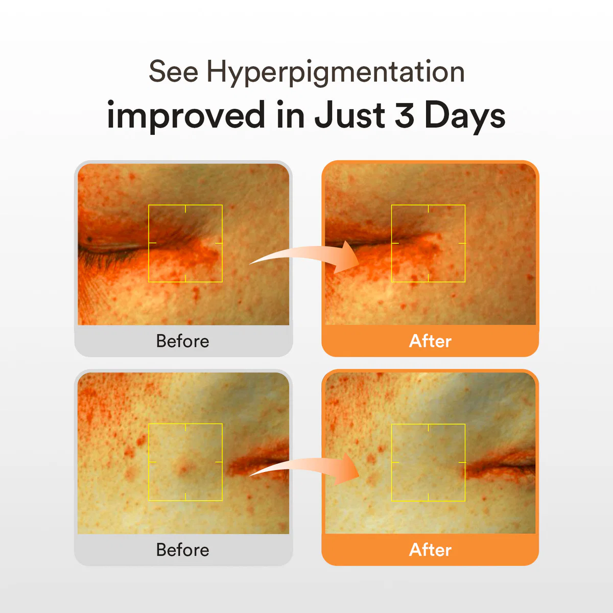 Abib serum for hyperpigmentation and dark spot care