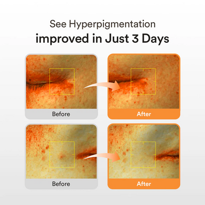 Abib serum for hyperpigmentation and dark spot care