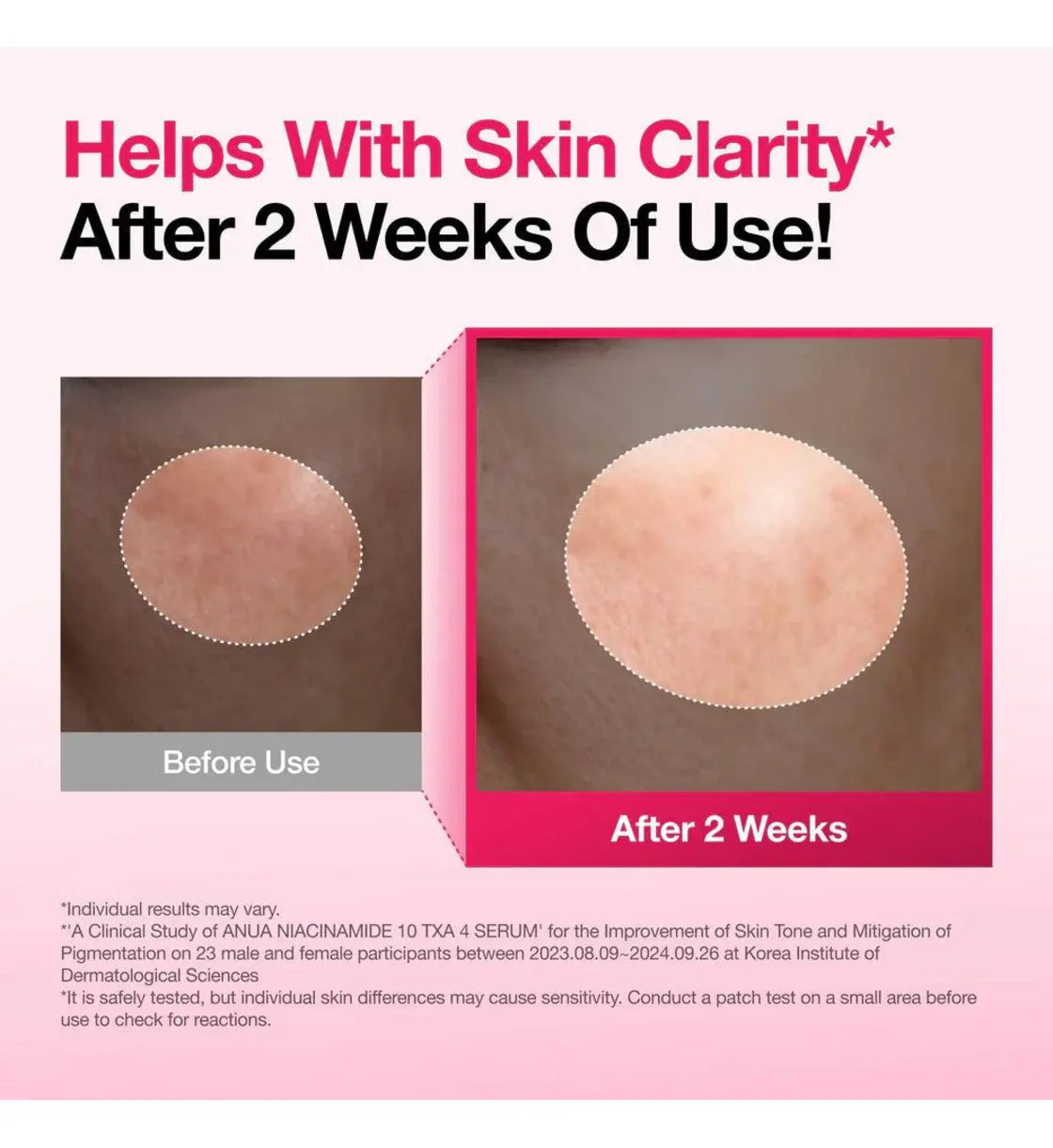 Anua Niacinamide 10% + TXA 4% Dark Spot Correcting Serum