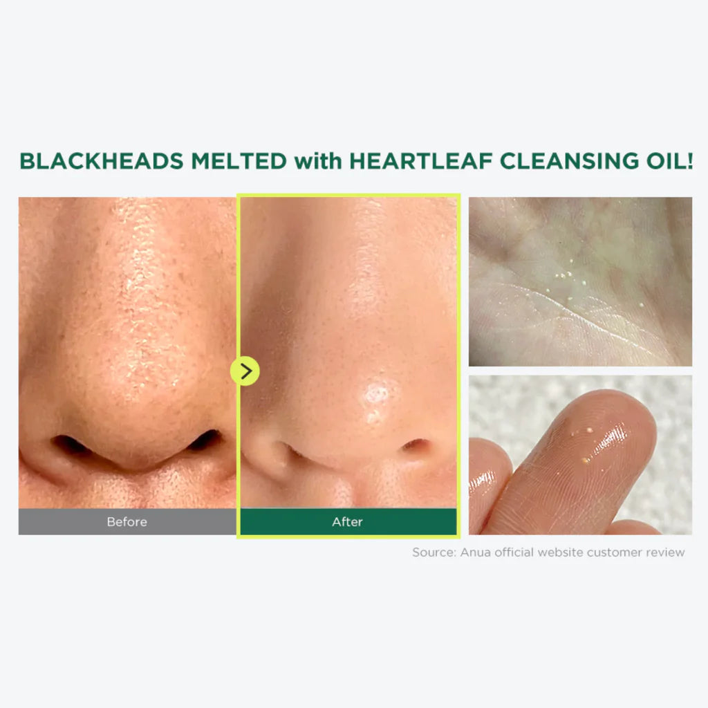 Anua Heartleaf Pore Control Cleansing Oil original in Pakistan