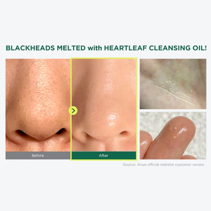 Anua Heartleaf Pore Control Cleansing Oil original in Pakistan