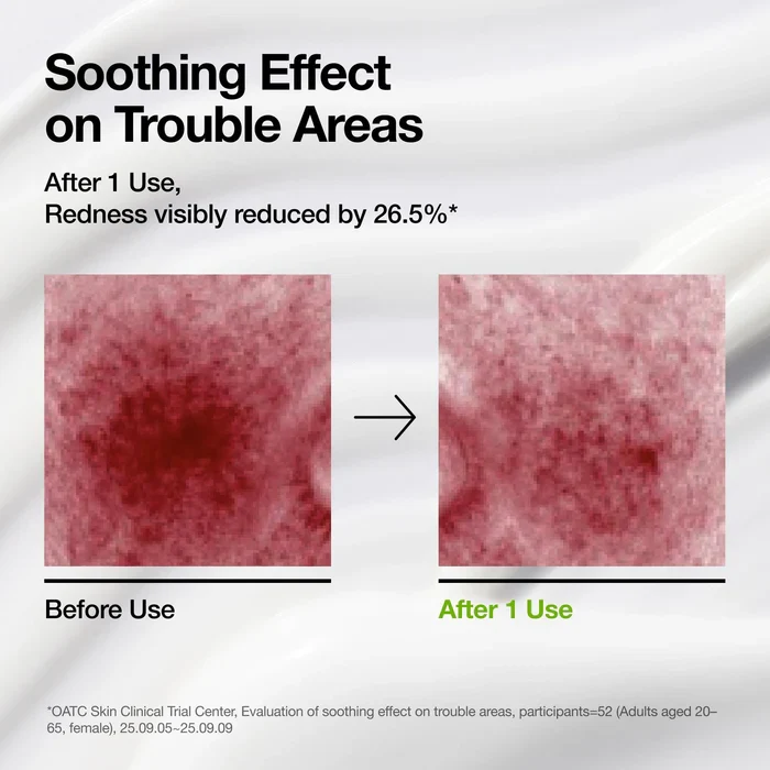 Anua Azelaic Acid Cica Skin Soothing Moisturizer