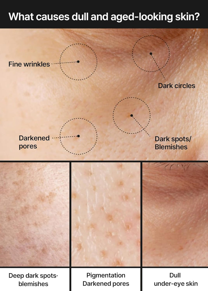 https://allurify.pk/products/celimax-pore-dark-spot-brightening-cream?variant=51770759807292