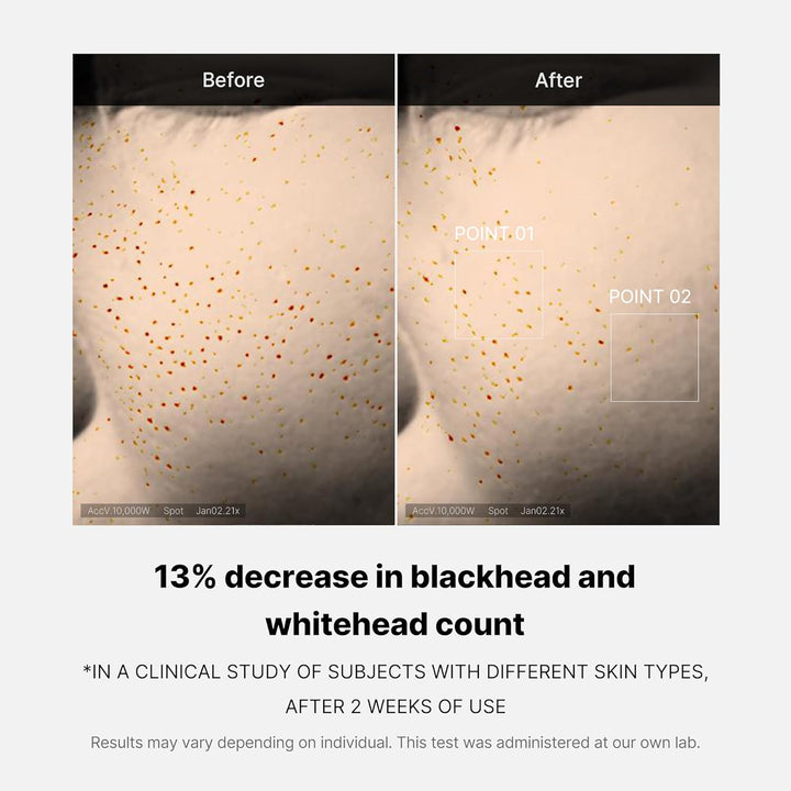 https://allurify.pk/products/medicube-zero-pore-one-day-serum?variant=51776418971964