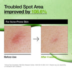 https://allurify.pk/collections/anua/products/anua-azelaic-acid-10-hyaluron-redness-soothing-serum?variant=50791941407036