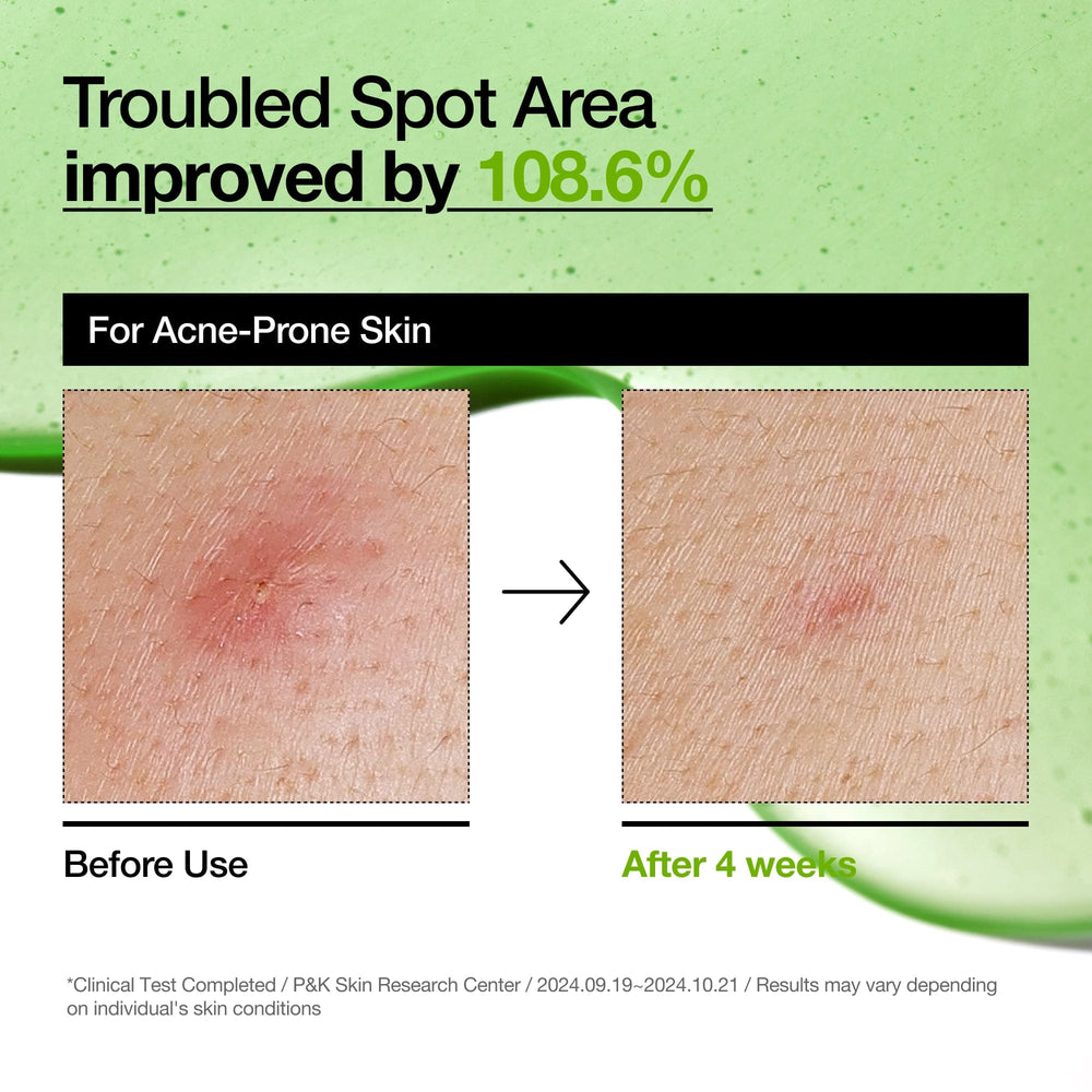 https://allurify.pk/collections/anua/products/anua-azelaic-acid-10-hyaluron-redness-soothing-serum?variant=50791941407036