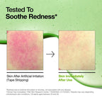 https://allurify.pk/collections/anua/products/anua-azelaic-acid-10-hyaluron-redness-soothing-serum?variant=50791941407036