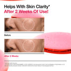 Anua Spotless Skin Duo