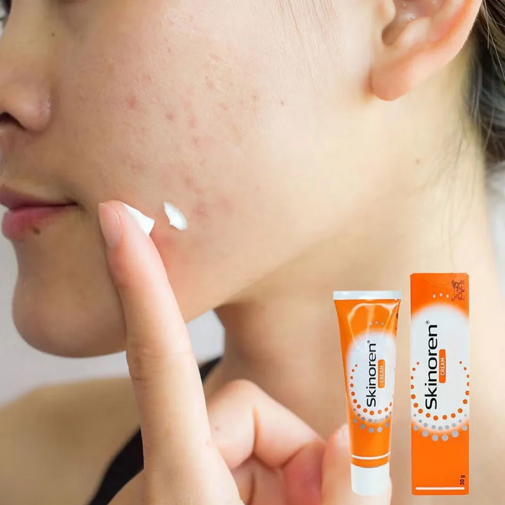 Skinoren Cream 30g  | Anti-acne Treatment